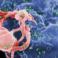 The Aids virus was created in a laboratory 200x200